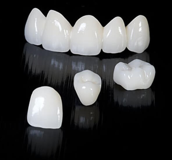 Các loại răng sứ